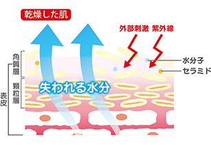 ［乾燥した肌］