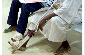 スーダン　マイセトーマ治療薬E1224治験サイト訪問